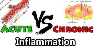 Acute Inflammation vs Chronic Inflammation  Clear Comparison [upl. by Namwen]