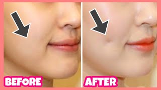 Create Dimples Fast and Naturally Dimples Exercises amp Massage [upl. by Holey311]