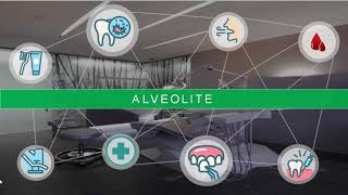 Alvéolite dentaire  étiologie  symptômes et traitement dentist [upl. by Seuqramed]