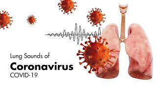 Sounds of Coronavirus COVID19  Lung Sounds [upl. by Oesile]