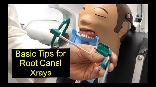 Basic Tips for Root Canal Xrays [upl. by Amr719]