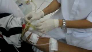 HEMODIALYSIS Procedure [upl. by Paderna978]