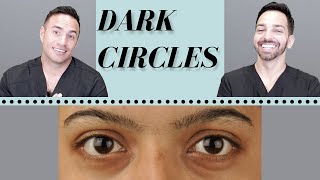 Dark Circles Causes amp Treatments  Dermatologist Perspective [upl. by Tudela313]