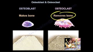 Osteoarthritis vs Rheumatoid arthritis in 2 mins [upl. by Anthiathia396]