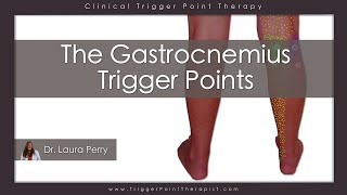 The Gastrocnemius Trigger Points [upl. by Othilia]