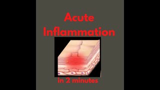 Acute inflammation in 2 mins [upl. by Abbe917]