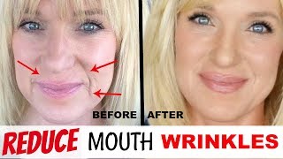 Get RID Of MOUTH WRINKLES WithOUT Fillers [upl. by Chernow73]