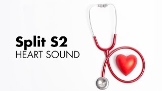 Fixed Split S2  Heart Sounds  MEDZCOOL [upl. by Chesney107]