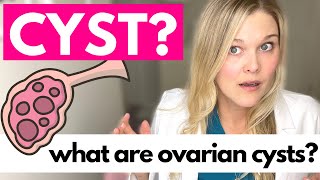 OVARIAN CYSTS What Causes Ovarian Cysts [upl. by Matthia]