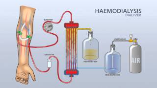 HAEMODIALYSIS DIALYZER [upl. by Airdnassac579]