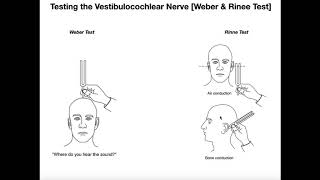 Interpreting the WeberRinne Tests EXPLAINED [upl. by Ynahirb199]