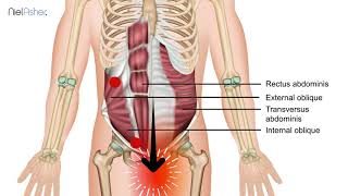 Oblique Muscles  Trigger Point Anatomy [upl. by Oirelav]