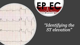 ECG Tip 1 Where is the isoelectric line [upl. by Binky]