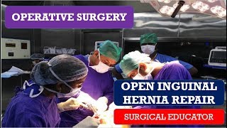 What is a hernia [upl. by Lehteb43]