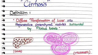 Cirrhosis of Liver  Pathology [upl. by Chrisman]