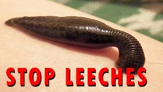 How to stop Leeches [upl. by Jaella960]