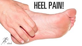 Plantar fasciitis Signs symptoms and treatment options [upl. by Nosyarg]