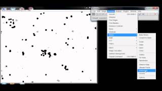 Counting Cells with ImageJ [upl. by Etnuaed]