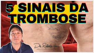 5 sinais da trombose [upl. by Gorlin]