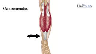 How To Find Trigger Points  Gastrocnemius [upl. by Solakcin829]