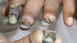 How Krokodil drug is madePreparation of a deadly Drug [upl. by Elery]