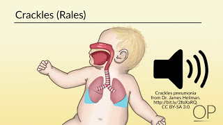 Respiratory Assessment by B Leary L DelSignore  OPENPediatrics [upl. by Alra]