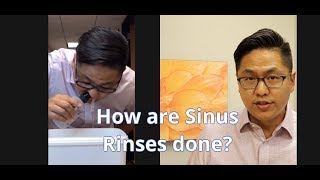 How to do a Sinus Rinse  demonstrated by Dr Arthur Wu rhinologist sinus specialist [upl. by Petunia719]