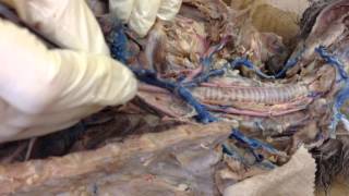 Introduction Neuroanatomy Video Lab  Brain Dissections [upl. by Nyasuh665]