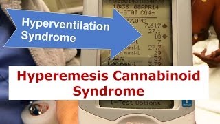 Cannabinoid Hyperemesis A Case Series of 98 Patients [upl. by Oiramej]