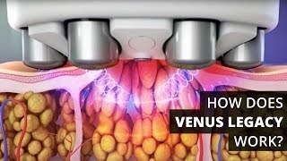 How Does Venus Legacy™ Work [upl. by Baptista617]