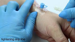 How to start IV drip Step by step tutorial from nurse [upl. by Ecidnacal]