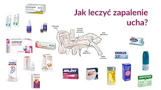 Jak leczyć zapalenie ucha [upl. by Standish]