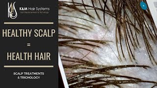 HEALTHY SCALP  HEALTHY HAIR  TRICHOLOGY [upl. by Nessej]