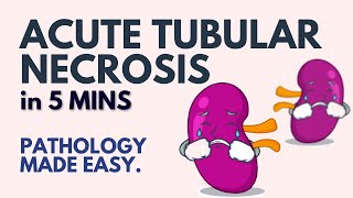 Acute Tubular Necrosis in 5 Minutes l Pathology Made Easy [upl. by Flann457]