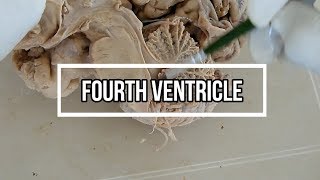 Fourth ventricle  neuroanatomy  floor  opening [upl. by Kroll]