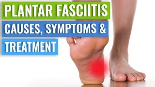 Plantar Fasciitis Causes Symptoms amp Treatment [upl. by Burny713]