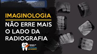 4 Dicas para leitura de região de Radiografias Periapicais  IMAGINOLOGIA [upl. by Hinkle944]