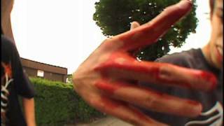 Skateboarding accidents falls crashes bails and pain Compilation [upl. by Bink]