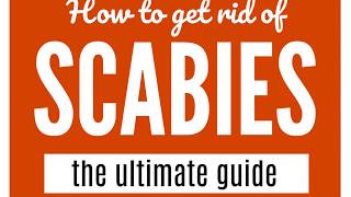 How To Get Rid Of Scabies A Guide That WORKS [upl. by Nylidam]