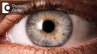 What is syneresis of the eye  Dr Elankumaran P [upl. by Nerha]