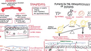 Types of Restrictive Lung Diseases [upl. by Adohr556]