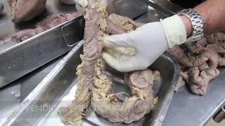 Anatomy Dissection of Large amp Small Intestine [upl. by Yelsnia]