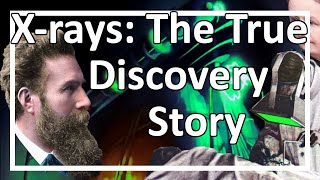 Wilhelm Röntgens Discovery of Xrays and its Momentous Implications [upl. by Savannah]