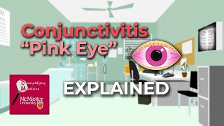 Conjunctivitis Pink Eye Explained [upl. by Scales640]