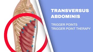 Abdominal Pain IBS and Trigger Points  An Overview [upl. by Einej]