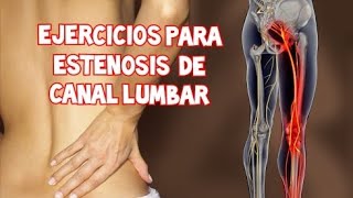 Ejercicios para ESTENOSIS DE CANAL LUMBAR [upl. by Nowell]