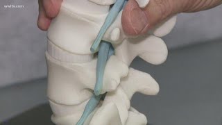 New procedure gives instant relief for spinal stenosis [upl. by Tommy]