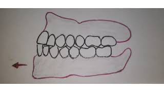 CONCEPTS OF OCCLUSION IN FIXED PROSTHODONTICS [upl. by Ferwerda]