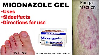 Miconazole nitrate cream  Uses sideeffects directions  Fungal infection treatment in Hindi [upl. by Misa]