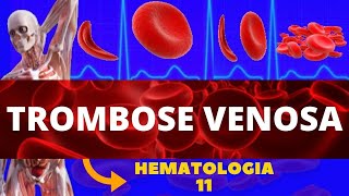 TROMBOSE VENOSA PROFUNDA FORMAÇÃO DE COÁGULO  HEMATOLOGIA TVP [upl. by Emmalyn]